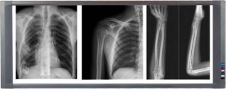 NEGATOSCOPIO LED 3 campos  8 intensidades | MedLight | Médicos
