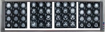 NEGATOSCOPIO LED  4 campos 8 intensidades | MedLight | Médicos